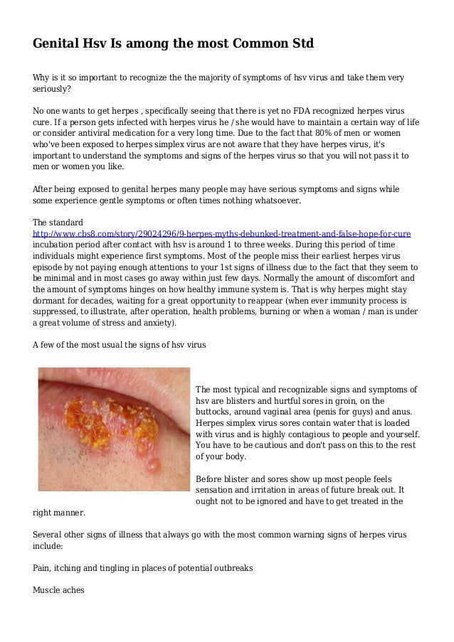 5 common stds